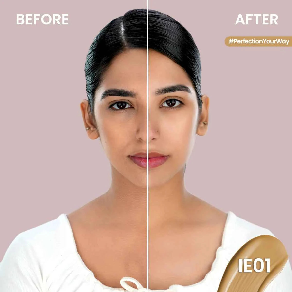 ST London - Imperfection Eraser | Skin Blemish & Spot Correcting Serum